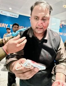 **दिल्ली एयरपोर्ट पर एयर इंडिया एक्सप्रेस के ऑफ-ड्यूटी पायलट पर यात्री से मारपीट का आरोप, वीडियो वायरल होने के बाद जांच के आदेश**